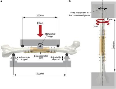 Intercalary reconstruction of long bones by massive allograft: Comparison of construct stability ensured by three different host-graft junctions and two types of fixations in a synthetic femur model